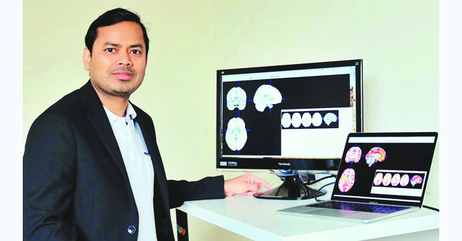 second-type-of-schizophrenia-discovered-nepali-scientist-leading-part-of-team