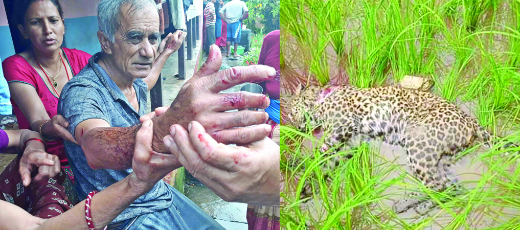 69-year-old-man-survives-fight-with-leopard