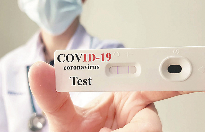 among-750-antigen-tests-41-positive-cases-detected