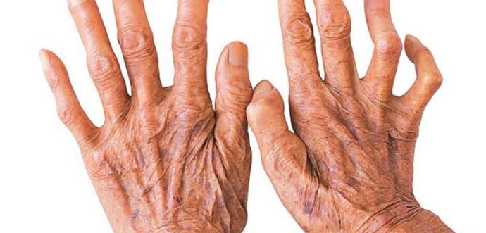 number-of-leprosy-patients-visiting-hospital-falls-amid-covid-19-pandemic