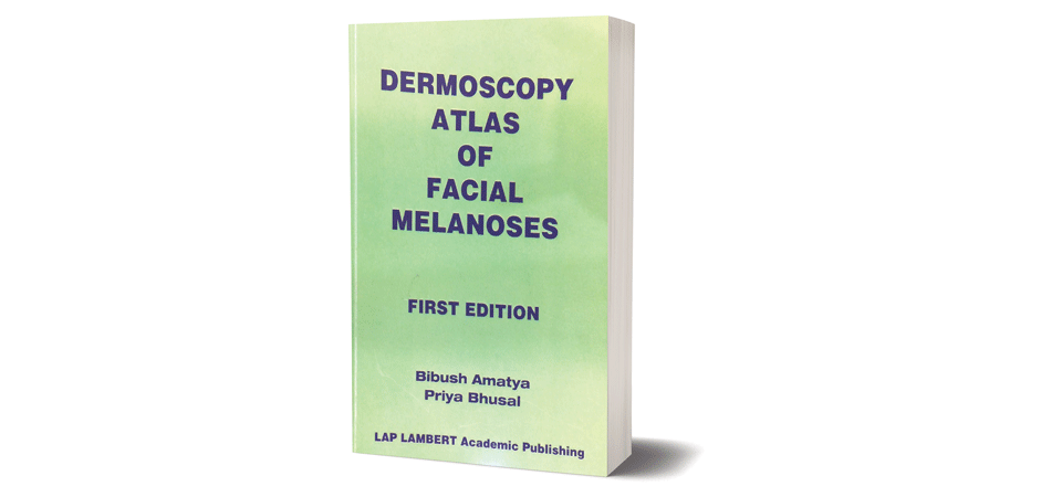 facial-melanosis-explained