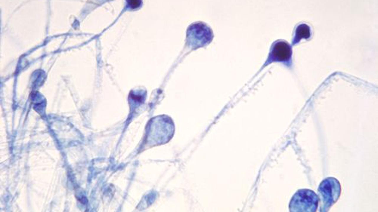 india-grapples-with-black-fungus-drug-shortage-as-cases-rise-among-covid-19-patients