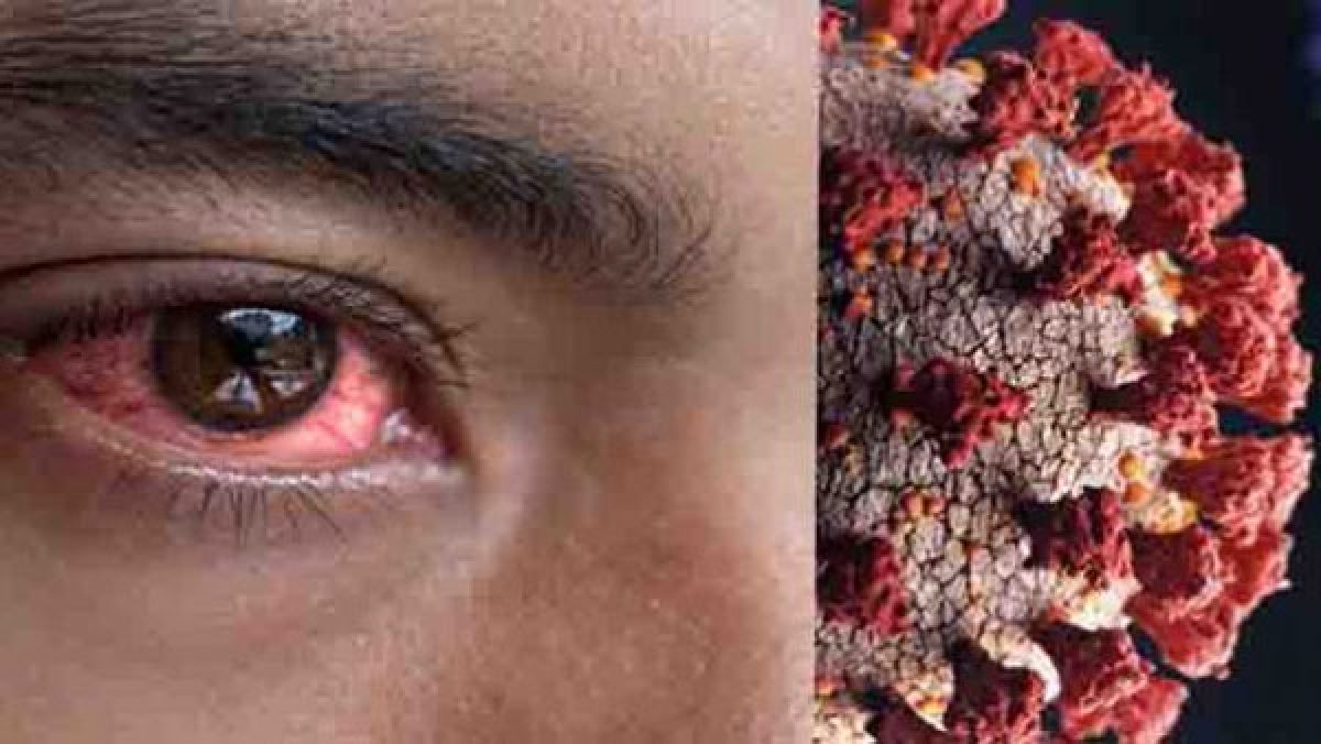 ophthalmologists-warn-of-possible-spread-of-black-fungus-infection-point-out-at-need-to-distribute-medicine-in-hospitals