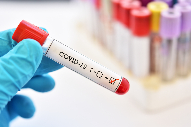 12-children-test-positive-for-covid-19