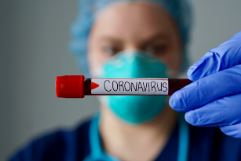 covid-19-103-throat-swab-samples-test-negative-for-coronavirus-in-state-1