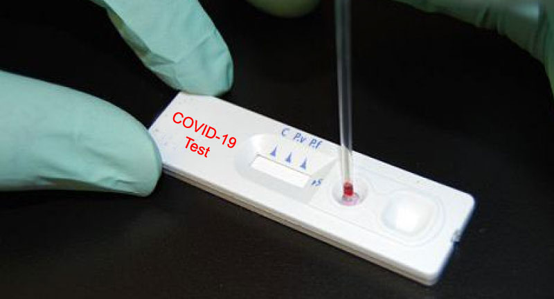 two-people-test-positive-for-coronavirus-in-rdt