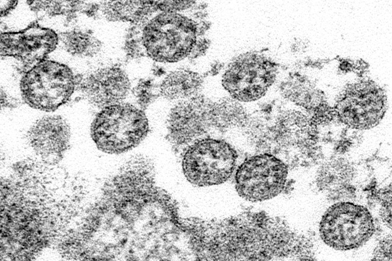 serious-coronavirus-linked-condition-hit-285-us-children