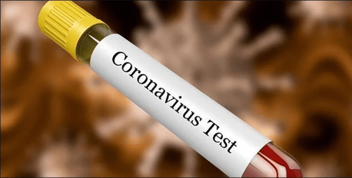 covid-19-test-now-available-with-fee