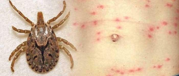 myagdi-records-more-cases-of-dengue-scrub-typhus