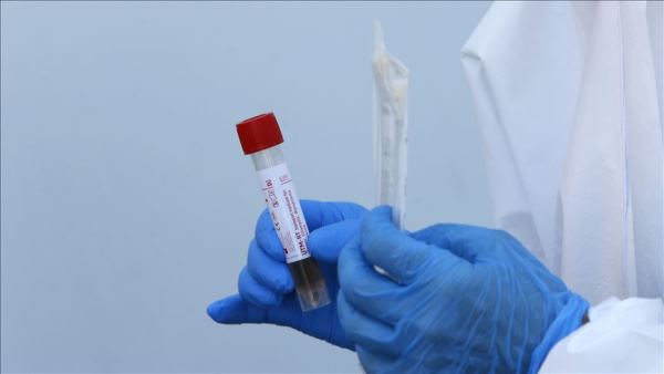 bharatpur-lab-closed-in-lack-of-reagent-of-pcr-test