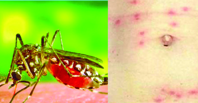 scrub-typhus-and-dengue-patients-on-the-rise