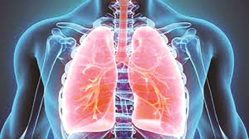 lung-infection-dominant-cause-of-covid-19-deaths